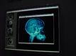 LG%2EPhilips+LCD+develops+20%2E8%2Dinch+medical+panel+