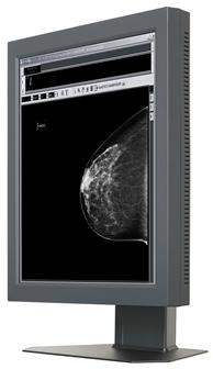 Chi Lin has successfully developed a 20-inch 5MP high-end medical monitor.