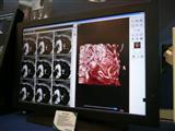 ICP's medical LCD monitor