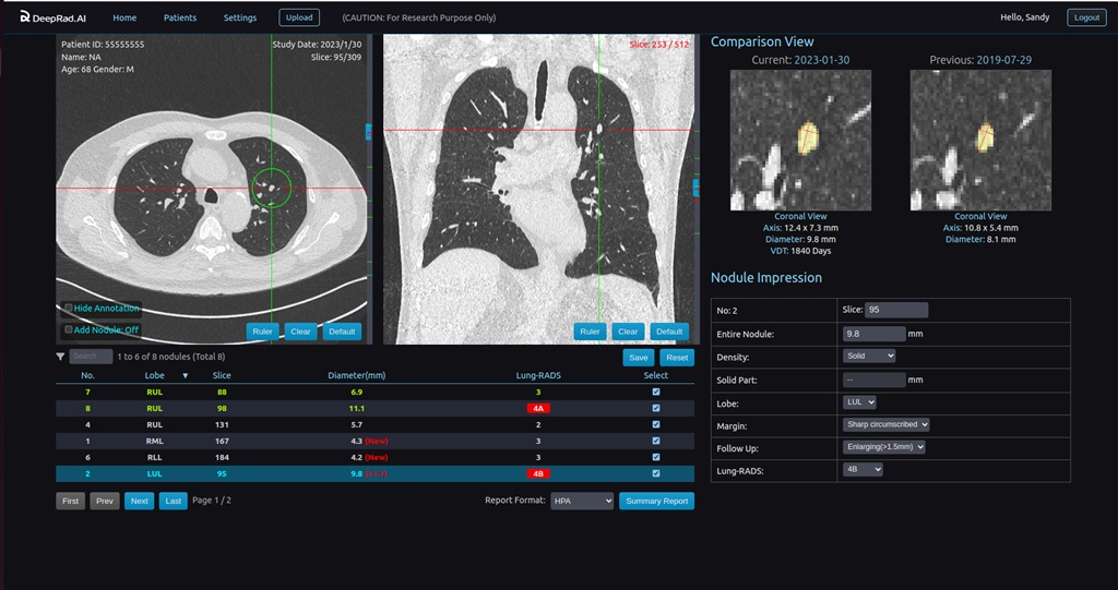 DeepRad.AI utilizes a single LDCT examination and multimodal AI technology to conduct a one-time scan of the lungs and heart